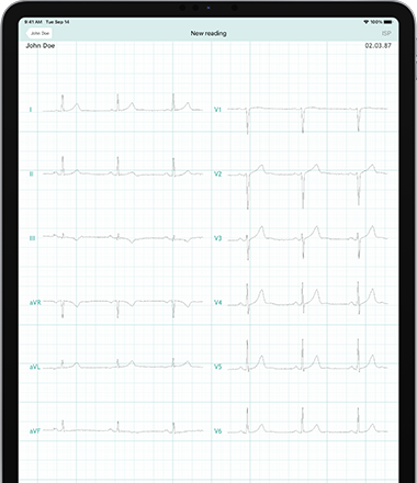 iPad Pro 12.9 inch with the CardioSecur Pro app during an ECG recording.